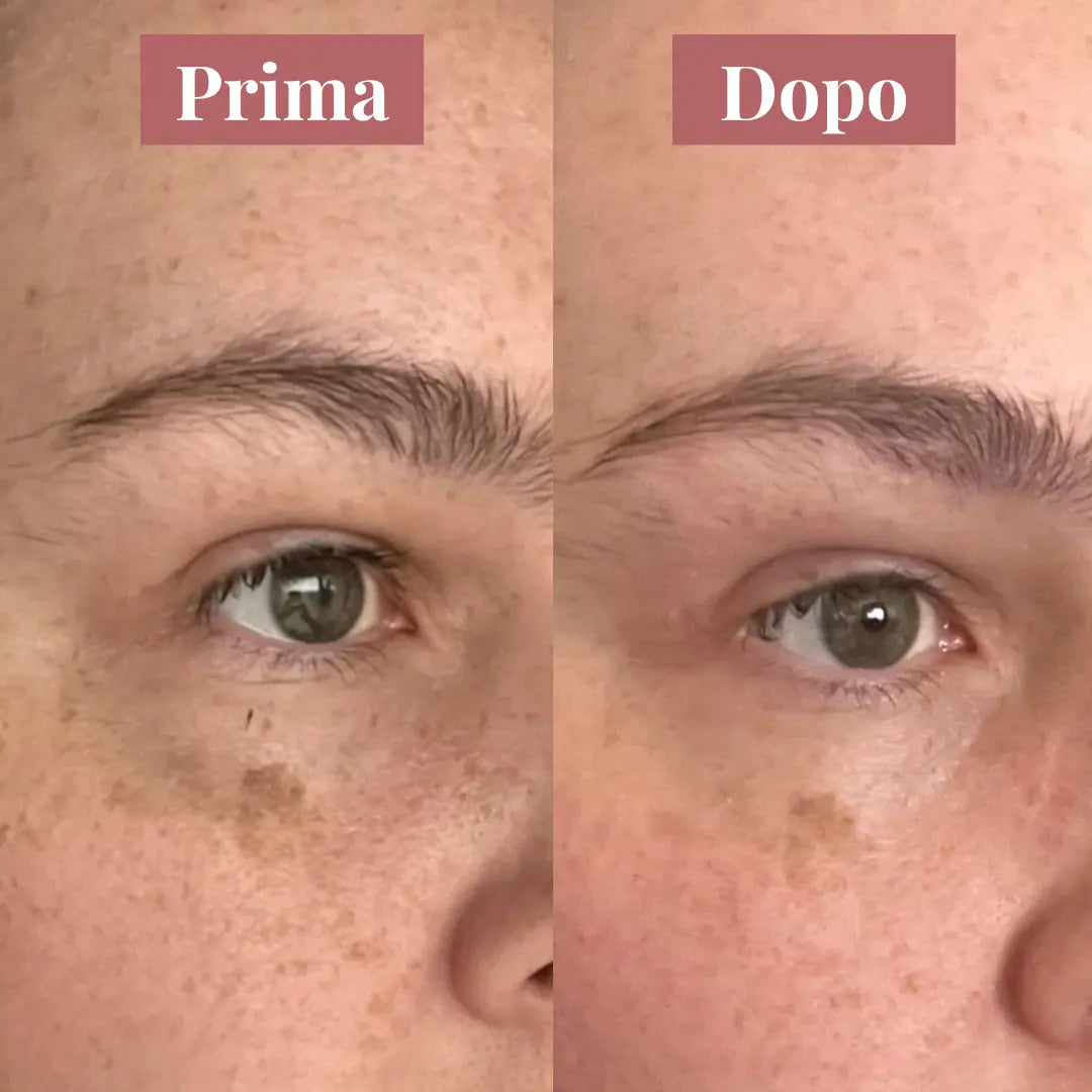 KojiGlow - Sapone illuminante anti-macchie