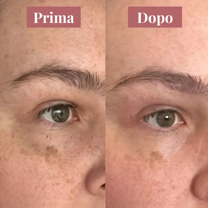 KojiGlow - Sapone illuminante anti-macchie