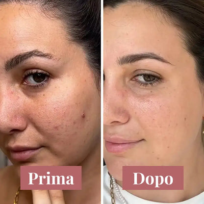 KojiGlow - Sapone illuminante anti-macchie